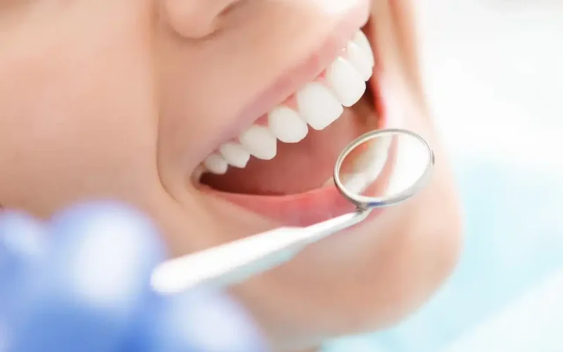 A close-up of a person smiling during a dental checkup, with a dentist’s mirror reflecting their teeth.