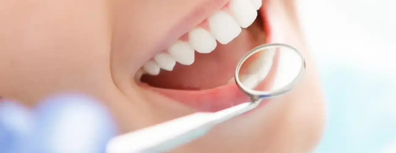A close-up of a person smiling during a dental checkup, with a dentist’s mirror reflecting their teeth.