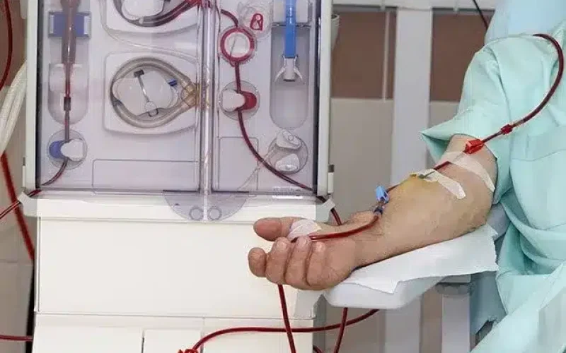 A person undergoes dialysis; blood is drawn from their arm through tubes connected to a dialysis machine.