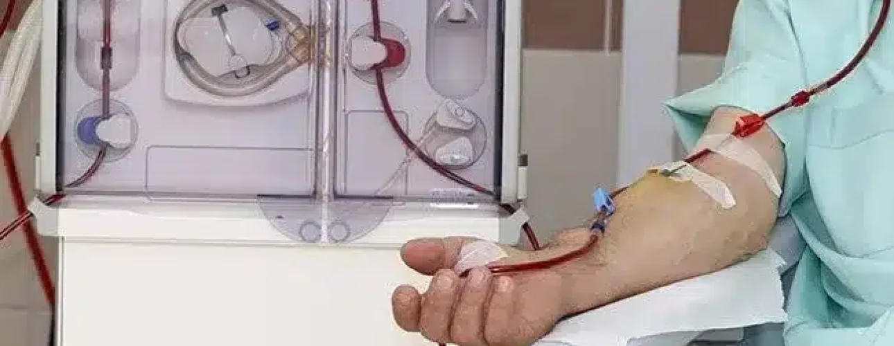 A person undergoes dialysis; blood is drawn from their arm through tubes connected to a dialysis machine.